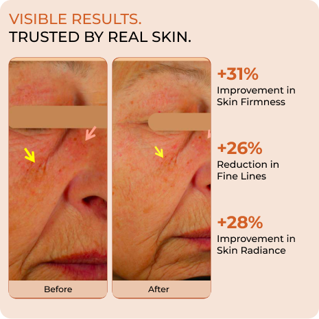 COMBO | Day Cream & Night Cream | Clinically proven visible results in 28 days