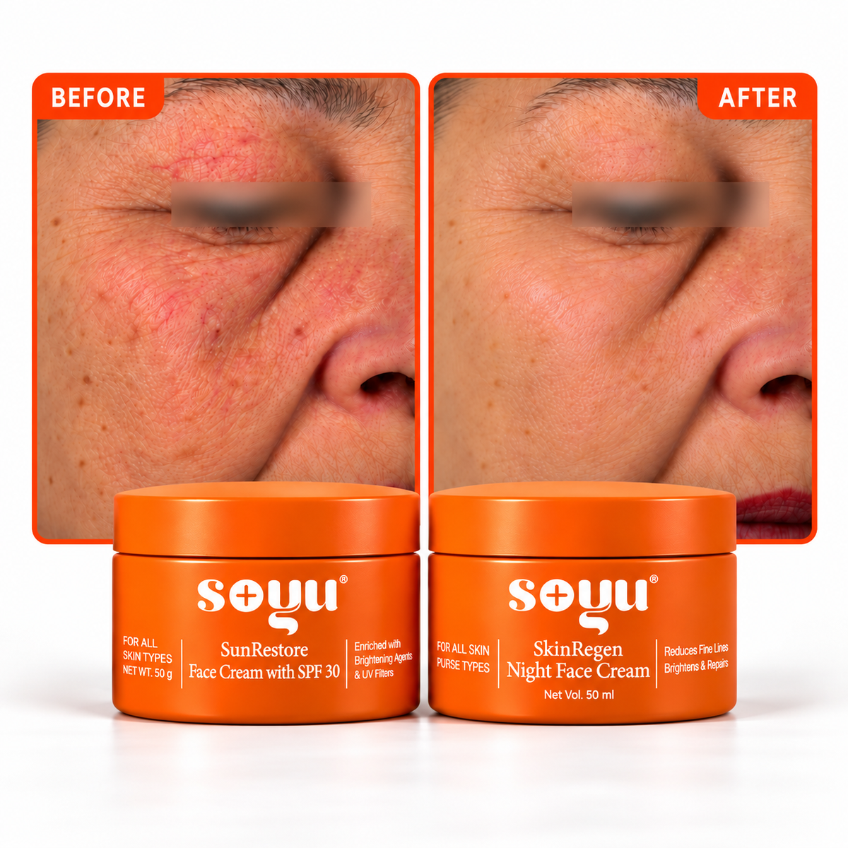 Soyu Face Care | Day Cream, Night Cream & Combo | Clinically proven visible results in 28 days